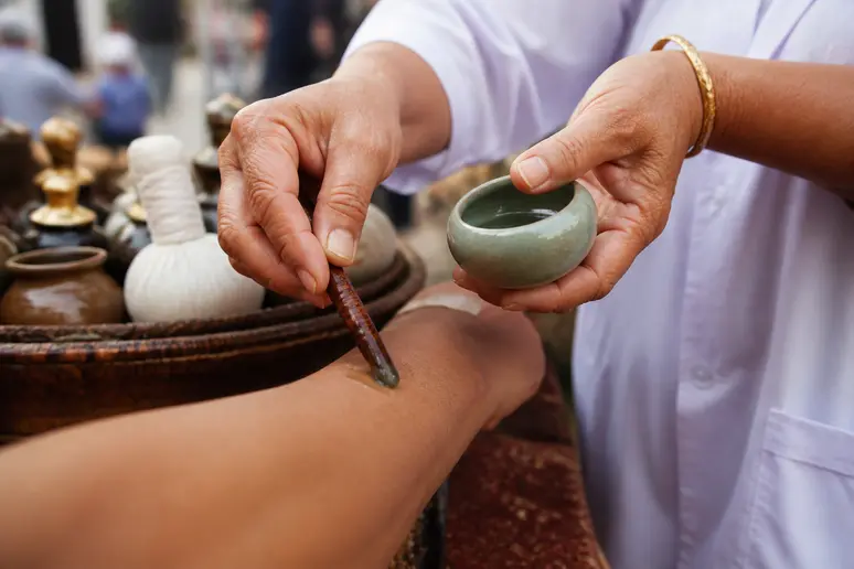 Ein thailändischer Apotheker trägt eine pflanzliche Salbe auf, um die Symptome eines Spinnenbisses zu lindern.